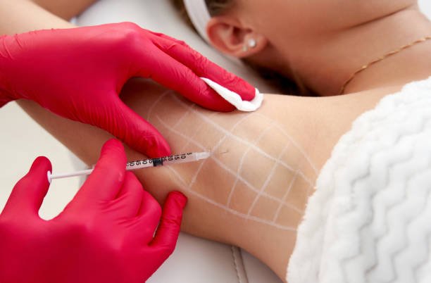 Is Botox Injections for Sweaty Glands the Right Choice for Heavy Sweating