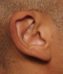 Is Ear Reshaping in dubai, abu dhabi & al ain Permanent?