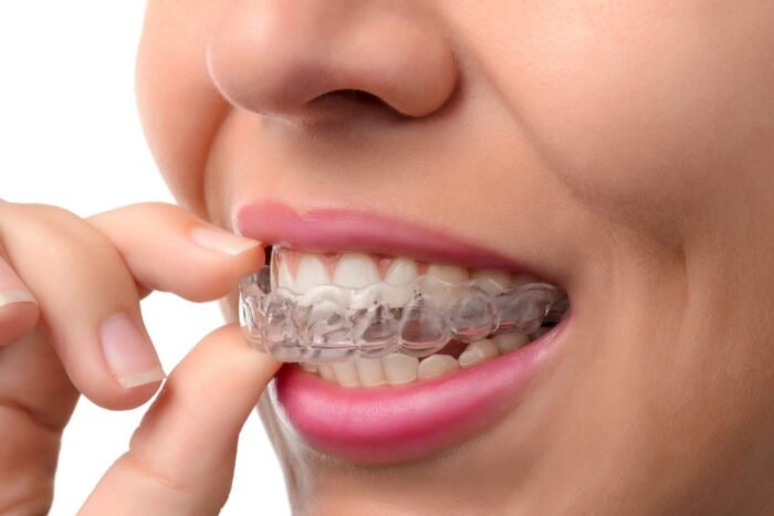 Invisalign Dentistry
