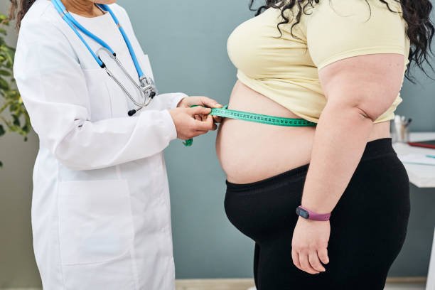 Obesity treatment Dubai