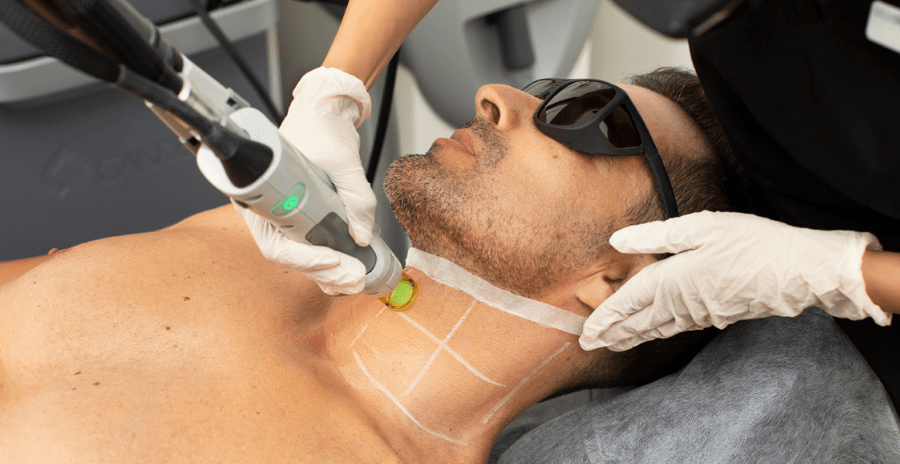 Laser Treatment Costs in Dubai