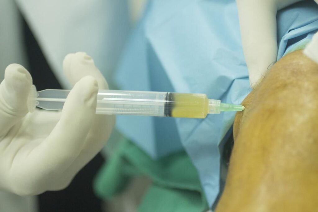How PRP Heals Knee Ligaments and Cartilage