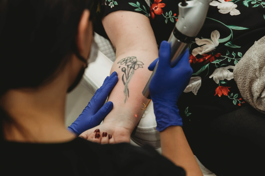 PicoSure Safety Standards at Dermatology Centers