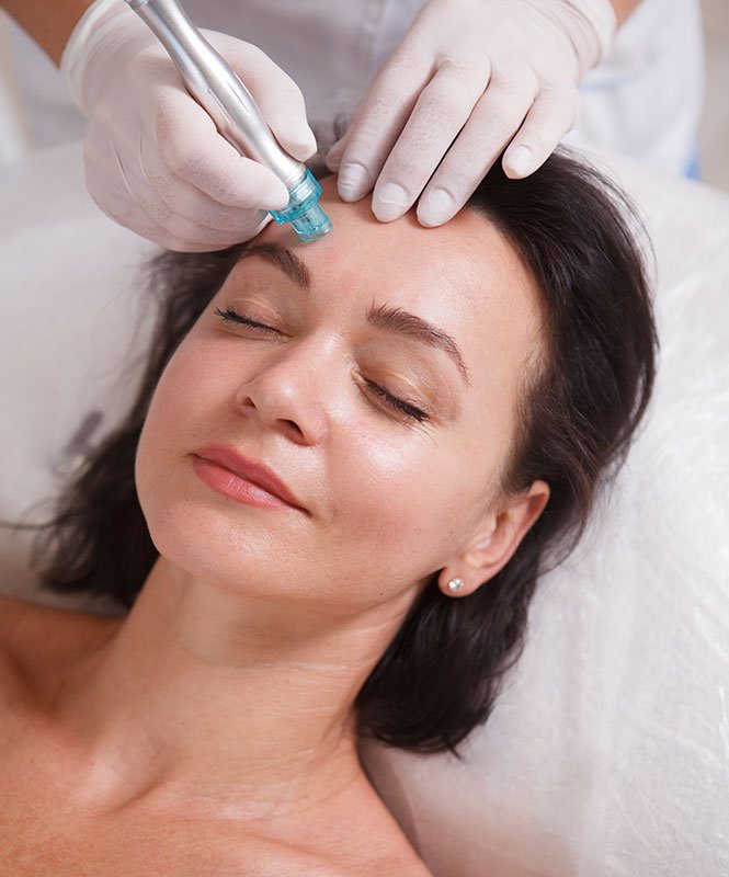 Can HydraFacial Reduce Large Pores?